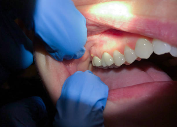 Best Emergency Dentist for Special Needs Patients in Country Squire Lakes, IN
